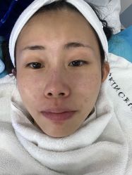 -伊丽莎白医疗美容