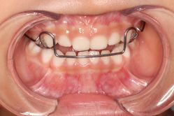 -青苗儿童口腔(长楹天街购物中心)