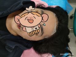 -海涛医疗美容·面部抗衰·注射美鼻