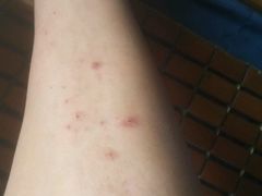 -杭州市第三人民医院