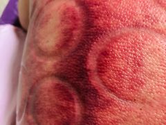 -沈师傅盲人按摩工作室(密三小区店)