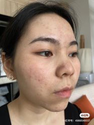 -skin79皮肤管理基站