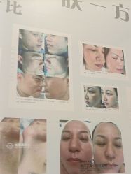 点击看大图 -禾壹净·素颜美问题肌肤修护中心