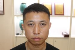 -大麦微针植发丨全国连锁