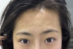 -天津健丽·去眼袋医疗美容机构