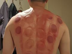 -正清和·推拿养生(黑石礁中心店)