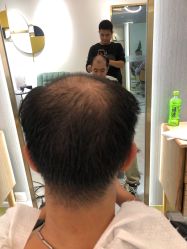 -发饰美男士增发补发假发定制店