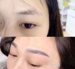-弘美医美·艾维岚童颜抗衰中心