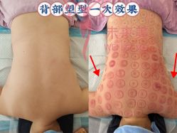 -未来美·减肥塑型瘦身纤体中心