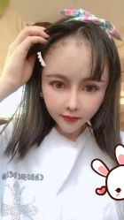 点击看大图 -大麦微针植发丨全国连锁