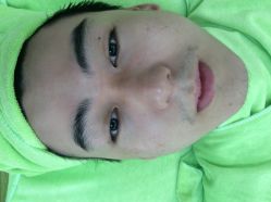 -苗医生草本科技祛痘