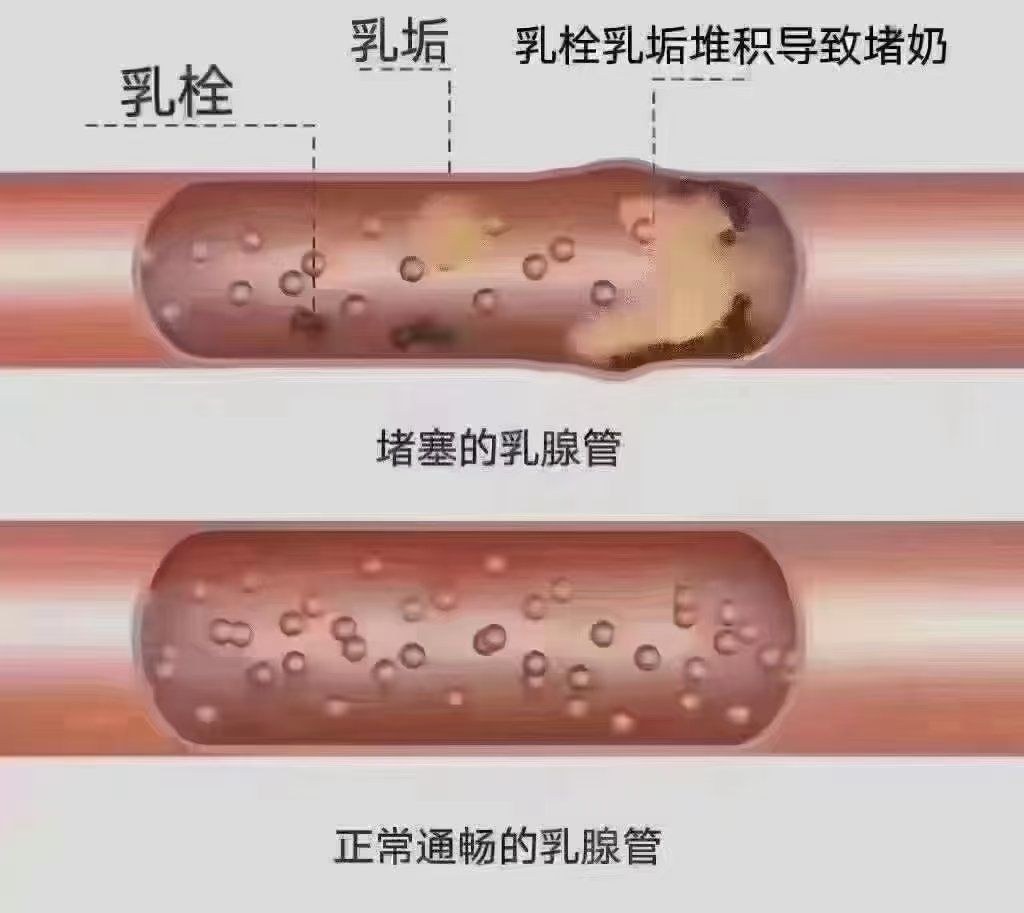 堵奶真的不要硬抗啊!