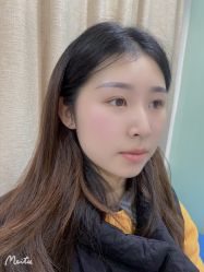 体验后-重庆联合丽格第五医疗美容医院