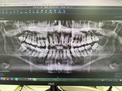 -欢乐口腔(望京分院)