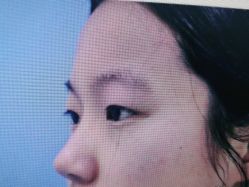 体验前-西安壹加壹医疗美容·西北抗衰旗舰店