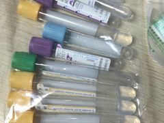-广州仁爱天河医院体检中心