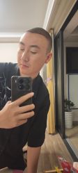 -大麦微针植发丨全国连锁
