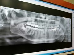 -土豆口腔(凤凰北总店)