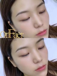 -OnFaer.纹眉半永久无创洗眉
