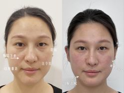 -Yestar重庆艺星医疗美容医院