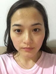 -欧扬医疗美容