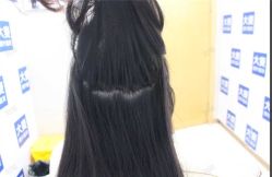 -大麦微针植发丨全国连锁