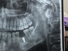 -牙博士口腔品牌连锁(杨浦店)