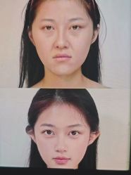 -东莞壹加壹整形美容医院