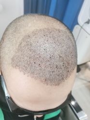 -雍禾植发全国连锁