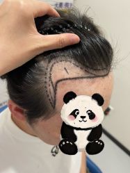 -大麦微针植发全国连锁