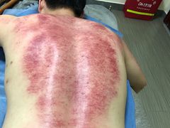 -张钰强中医正骨推拿连锁(唐家人才公寓店)