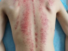 -佰推·肩颈腰·推拿理疗(湾悦城店)