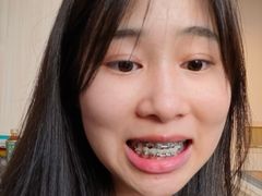 -极光口腔·矫正种植修复(锦江店)