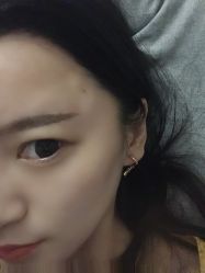 -南京健丽·去眼袋医疗美容机构