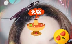 -大麦微针植发全国连锁