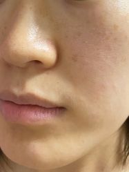 体验后-圣嘉新医疗美容医院