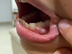 -爱贝口腔·牙周诊疗·种植修复中心