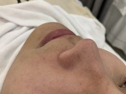 -skin79皮肤管理中心
