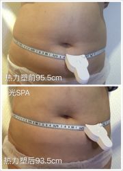 光SPA热力塑瘦身-光SPA科技美肤