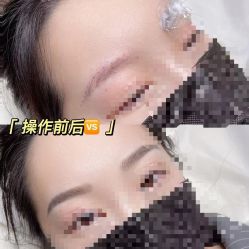 -久匠·纹眉纹绣半永久