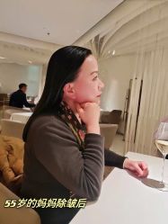 体验后-More摩尔医美の注射线雕光电中心