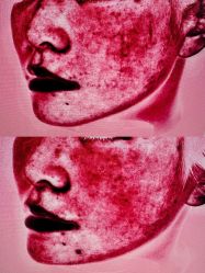 -和颜一美轻医美连锁