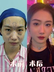 -郑荃丽格医疗美容