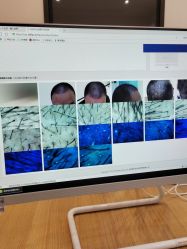 -雍禾植发全国连锁