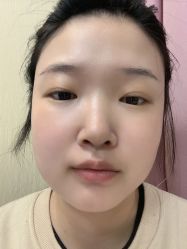 体验后-西安现代妇产医院医疗美容