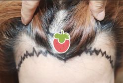 -大麦微针植发全国连锁