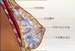 -玛莲朵·海菲秀冰珀科