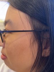 -长沙雅美医疗美容医院