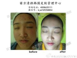 点击看大图 -苗方清颜痘肌研究所