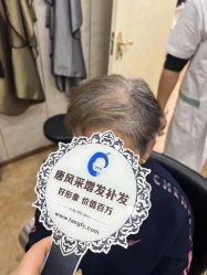 -唐风采假发补发定制
